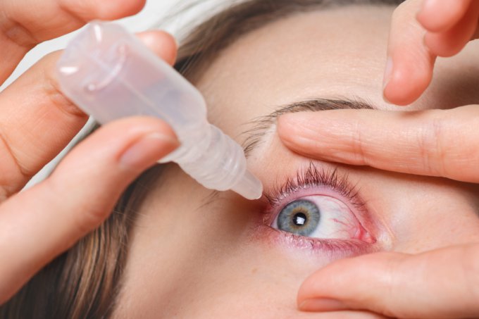 Łzawienie oczu - leczenie