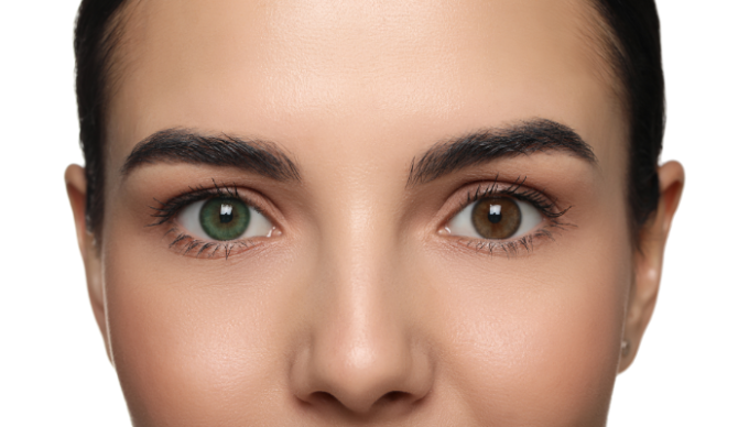 Kobieta. Dwa kolory oczu. Heterochromia.